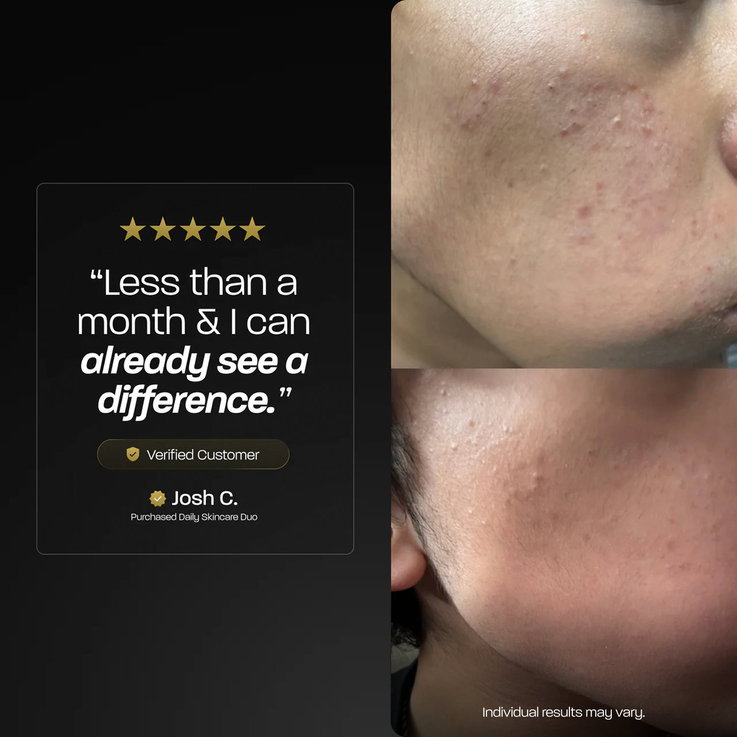 Daily Skincare Duo - View 2